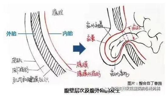 娃娃得了疝氣不要怕，阜陽市婦女兒童醫(yī)院小兒外科來幫您！