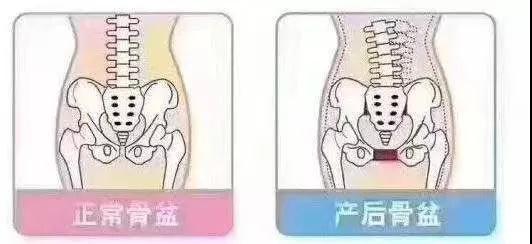 產(chǎn)后身材變形？你可能錯過了這個……